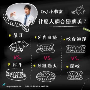 Read more about the article Dr.J 小教室：什麼人適合隱適美？