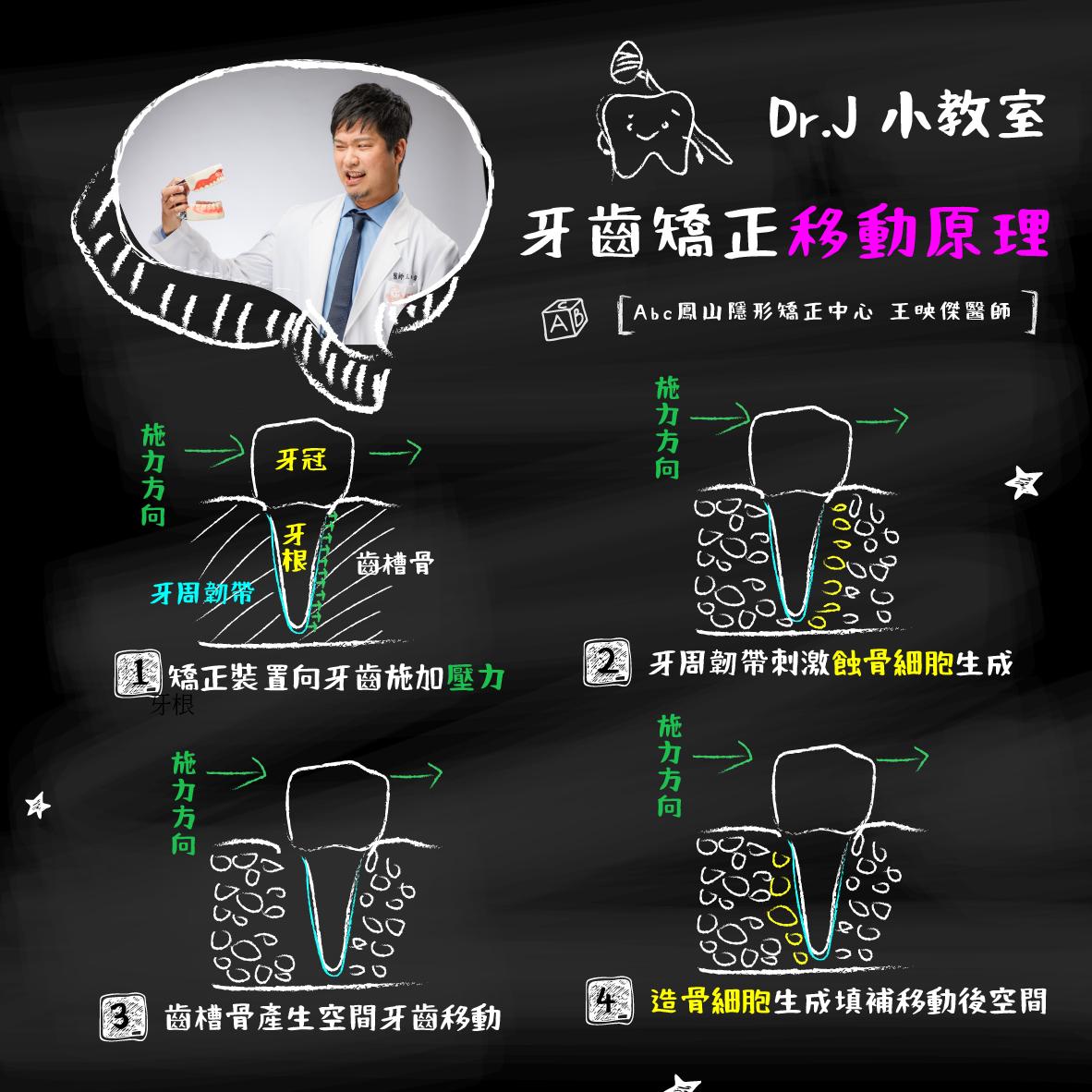 You are currently viewing Dr.J 小教室：牙齒矯正移動的原理